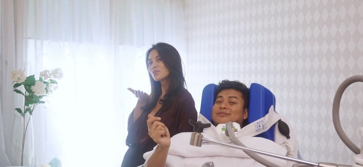 Coolsculpting before and after treatment