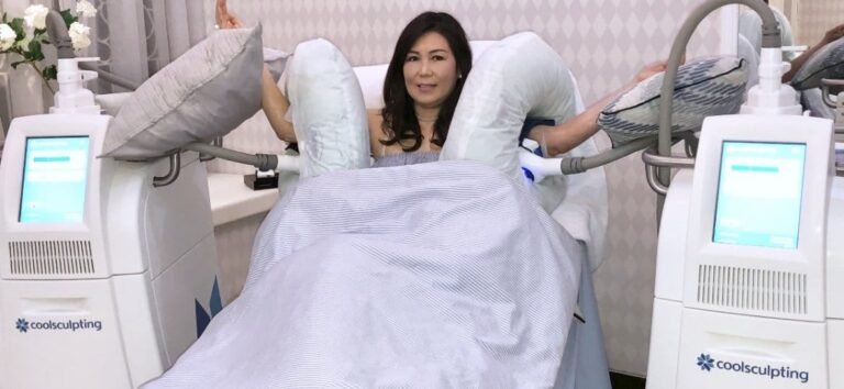 How long does coolsculpting last