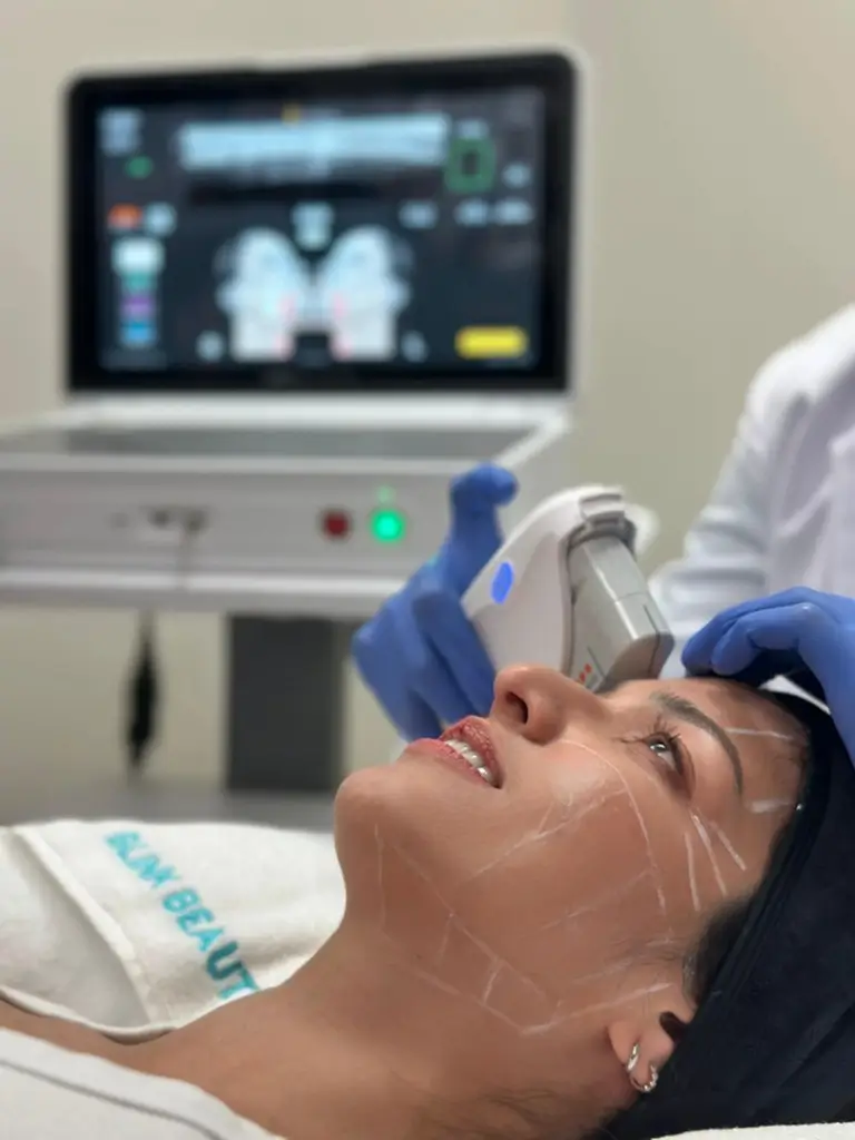 1. ultherapy prime