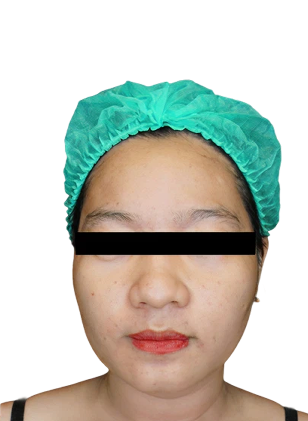 Hasil pengangkatan wajah 01 1 3