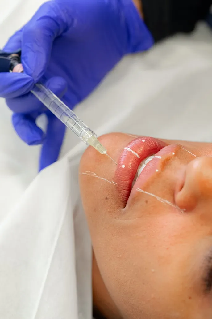 Juvederm